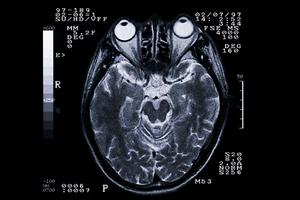 国立市の便利な立地にある眼科医院で忙しい40代女性にぴったりの目のケアを体験しよう